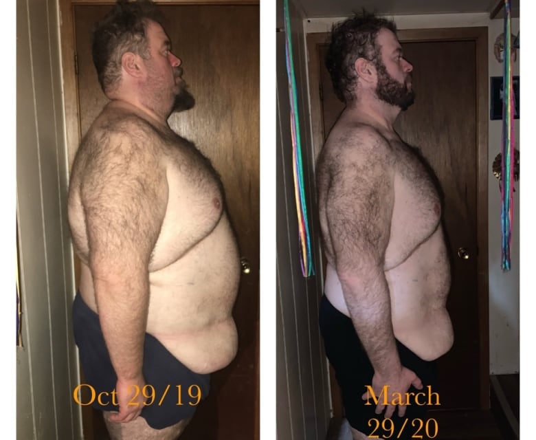 A before-after side view of a man who has lost a lot of weight. 