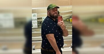 Bariatric surgery only half the battle: Costly excess skin to remove in NB