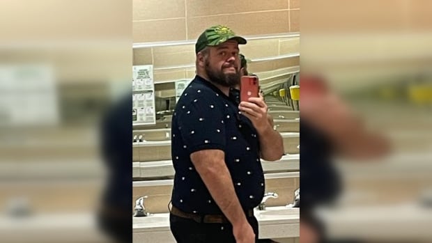 Bariatric surgery only half the battle: Costly excess skin to remove in NB