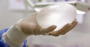 Essential but long overdue National Breast Implant Registry, say patients and doctors
