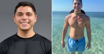 Dietitian Explains How Eating Up To 5 Eggs A Day Transformed His Health