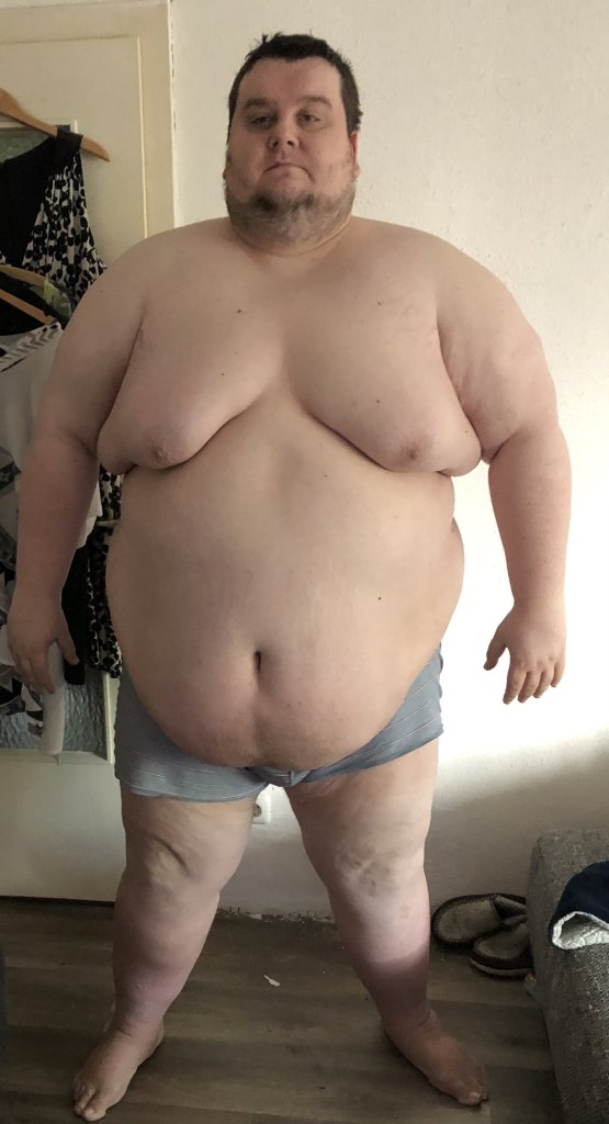 Michael Mehler, 38, has lost 360 pounds after undergoing weight loss surgery and adjusting to a healthy diet.
