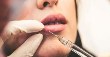 Is the "Ozempic face" a thing? Surprising Side Effects of Weight Loss Drug