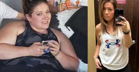 Woman loses 104 pounds after bariatric surgery