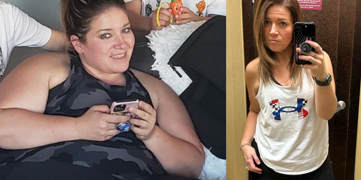 Woman loses 104 pounds after bariatric surgery