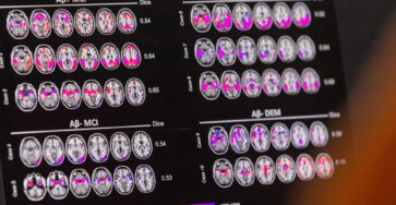 US government approves Alzheimer's drug to slow cognitive decline | Health info